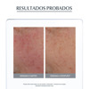 Imagen de EUCERIN ANTIENROJECIMIENTO CREMA DE DÍA 25 fps 50 ml